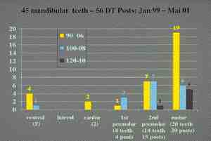 TABLE 6 Number and dimension of double taper posts placed in mandibular teeth.