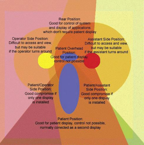 Common Placement Configurations -- The sites most often used for component placement in an operatory.