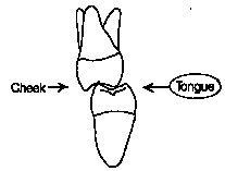 FIGURE 9--Neutralization - a benefit of intra-incline space.