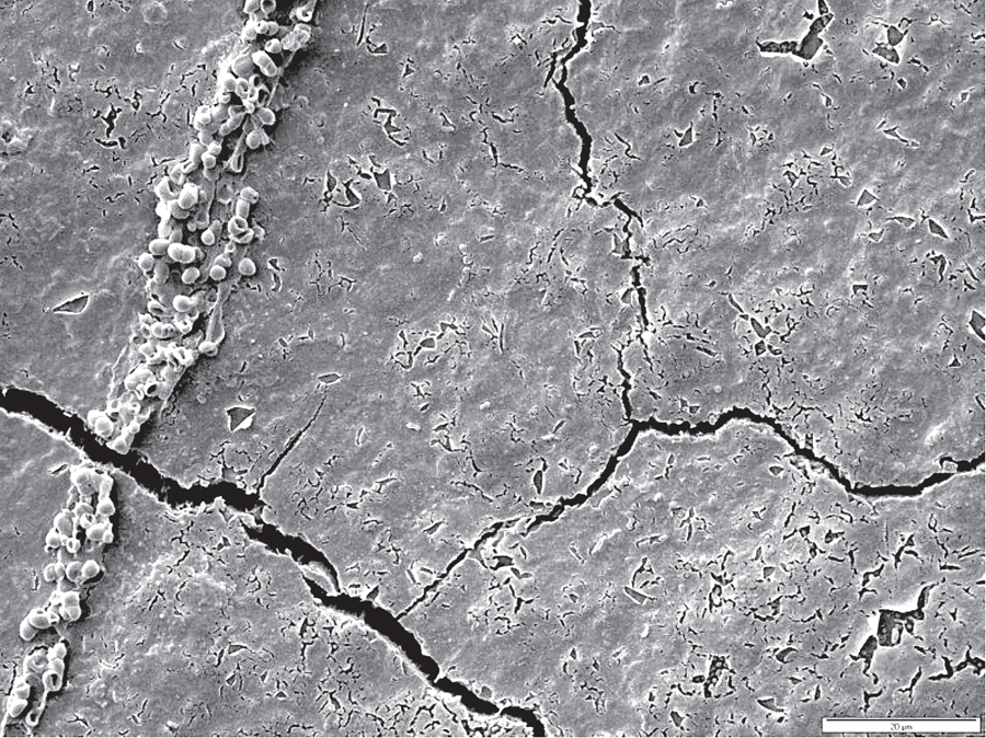 Figure 5B. 99.9% removal of biofilm from tooth surface after 3 seconds of treatment with a water flosser under SEM.