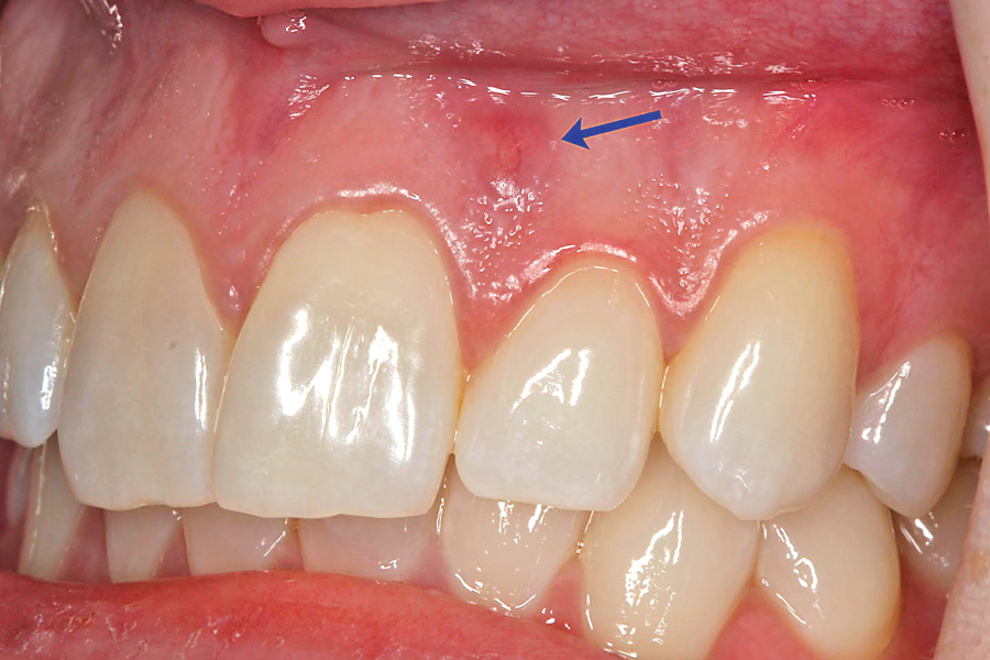 1002621084-1002621087 - Oral Health Group