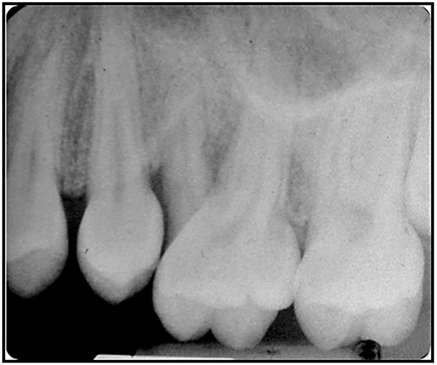 FIGURE 5H. - side 2b - after.