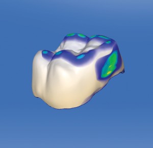 FIGURE 8. Colour Map of the Proximal Contact