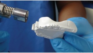  FIGURE 4. Heat applied to alter and shape the plastic tray as required to approximate edentulous ridge anatomy.