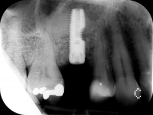 FIGURE 7. Three-month follow up.