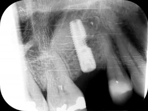 FIGURE 8. Six-month follow up.