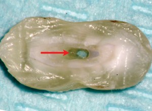 FIGURE 5. Model cross-sections of the root canals prepared using Revo-S rotary system: a) clean canal, b) canal polluted with pulp remains.