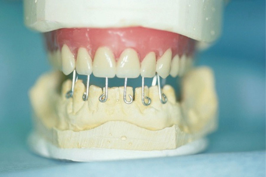CAD-CAM Surgical Guides for Implantology: The New, The Old and The ...