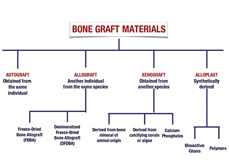 Biomaterials In Implant Dentistry