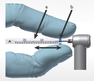 The canal working length is fixed by using a plastic tooth to adjust the rubber stopper and cooled down inside the tube using a cold spray.