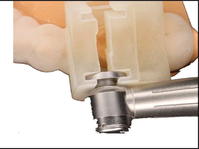 Occlusal guide positioned on model with handpiece.