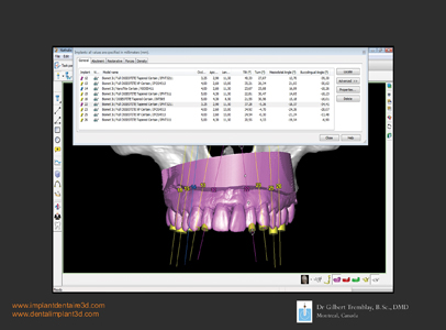 This detailed figure includes: implants angulations, buccal to lingual, mesio-distal and rotations.