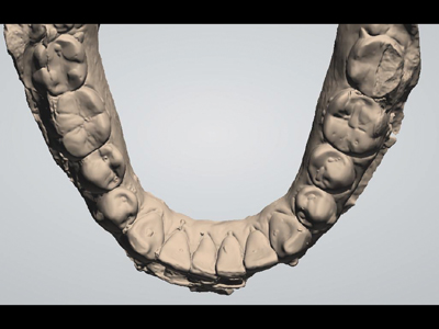 Initial mandibular arch.