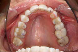 Contact Canted The Systematic Treatment of a Canted Smile - Oral Health Group