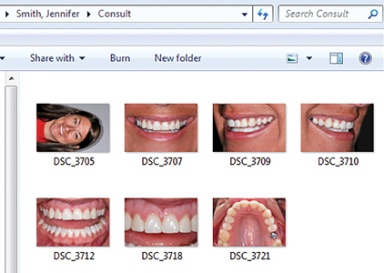 Any time a patient comes in with an anterior/aesthetic concern, someone on the staff should start with a few images and review with the patient on a large monitor.