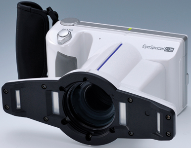 The Shofu EyeSpecial C-III has a built-in flash and lens.