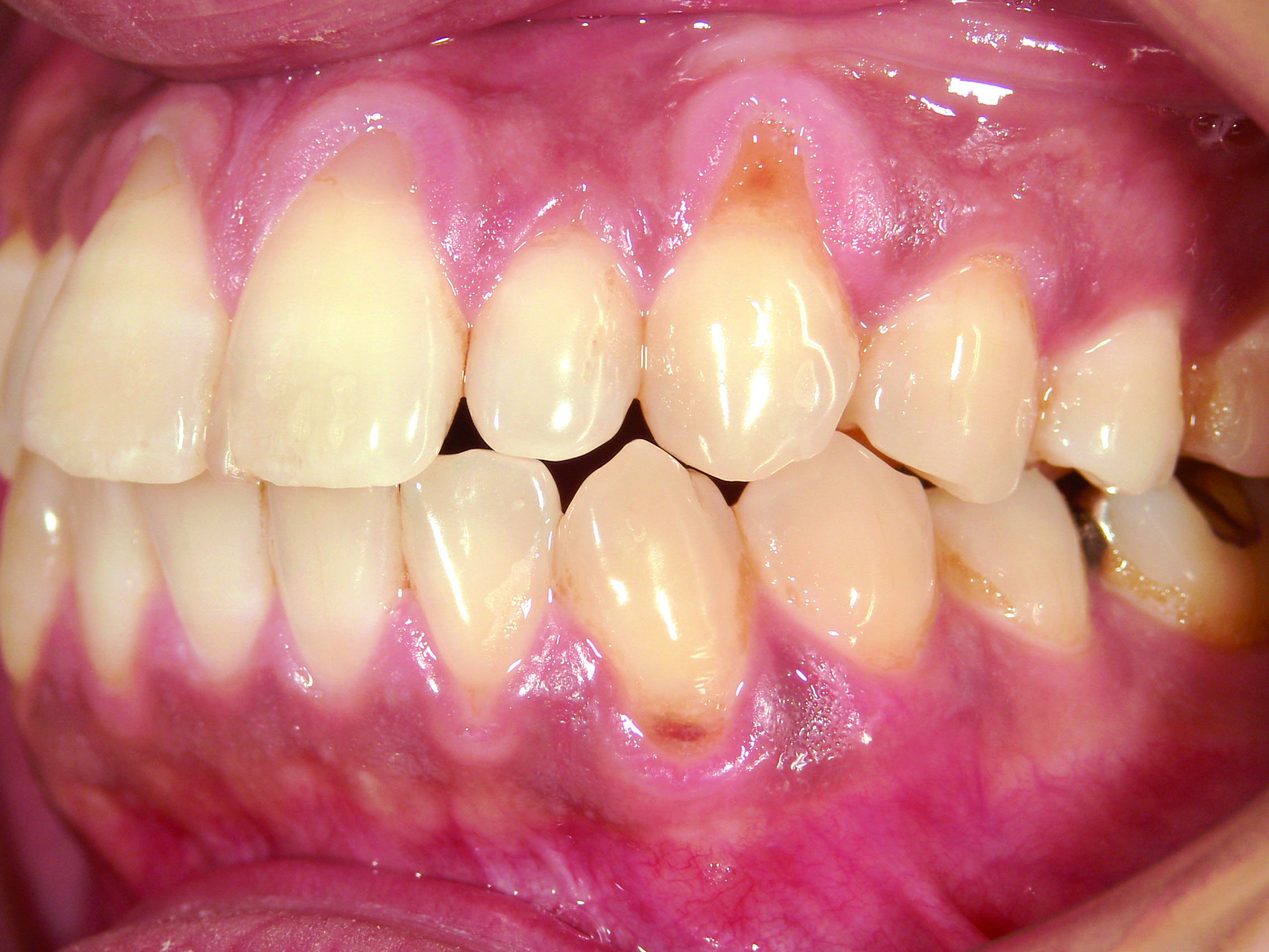 SHOFU DENTAL DIGITAL CAMERA Oral Health Group