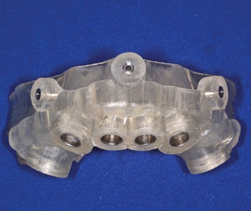 Stereolithographic implant guide seated on the bone reduced model.