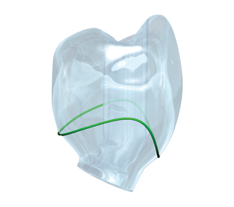 This translucent design of the final restoration highlights the contours of the definitive restoration relative to the soft tissue cuff (green line) and the position of the corrected access channel.