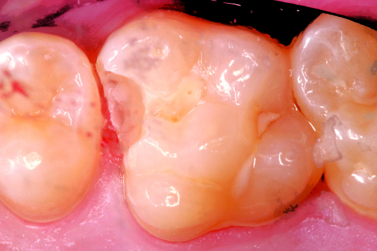 Technology In Minimally Invasive Dentistry Oral Health Group