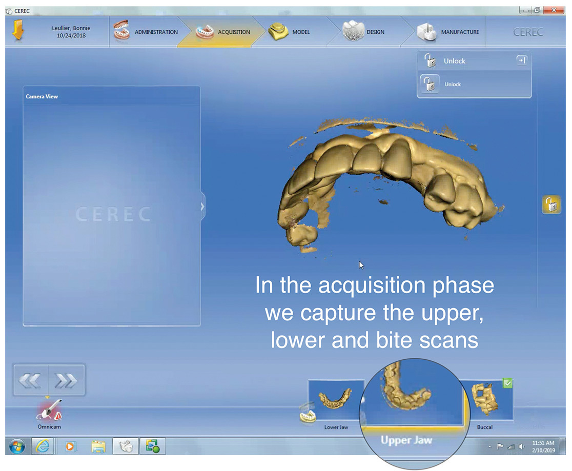 Intraoral scanning and digital models