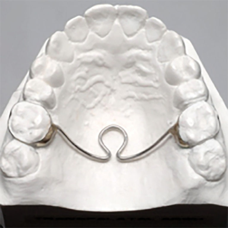 Space Maintainers Made Easy Oral Health Group