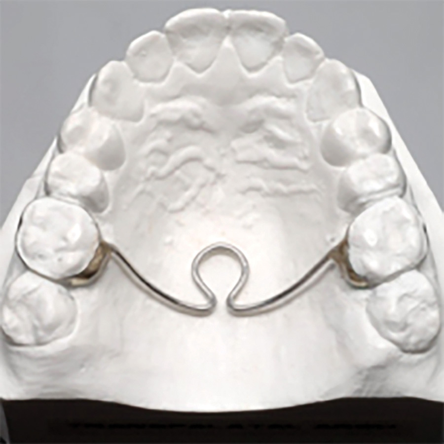 Pediatric Chairside Space Maintainer Crown Kits - Denovo Dental