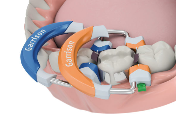 Fusion-MOD - Oral Health Group