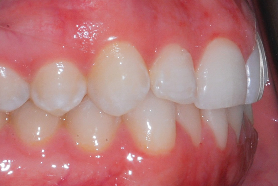 Pre-op right view.