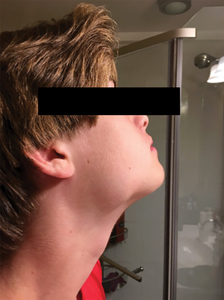 Right-sided extraoral photo.