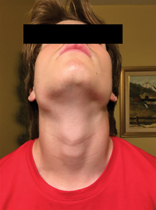 Photographie extra-orale, vue de face.