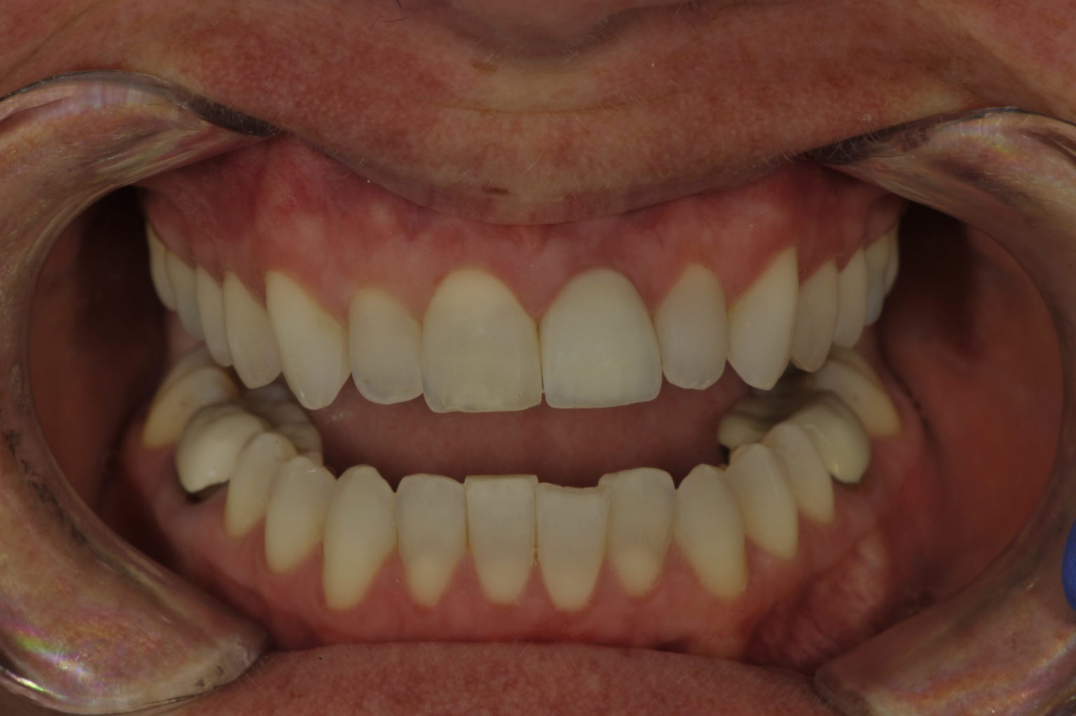 Photography Essentials in Dentistry Oral Health Group