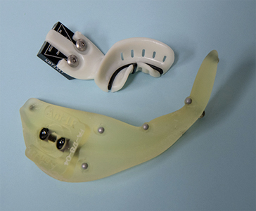 Design of a two-layer filling in Rayo 3DToothFill software. 