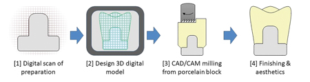 Steps in the CAD/CAM manufacturing technique.