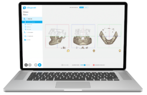 Picture 3: Case planning with the new coDiagnostiX EASY Mode