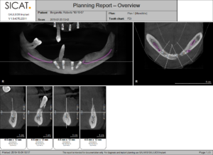 Pre-Operative assessment of the patient.