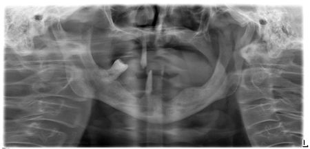 Pre-Operative assessment of the patient.