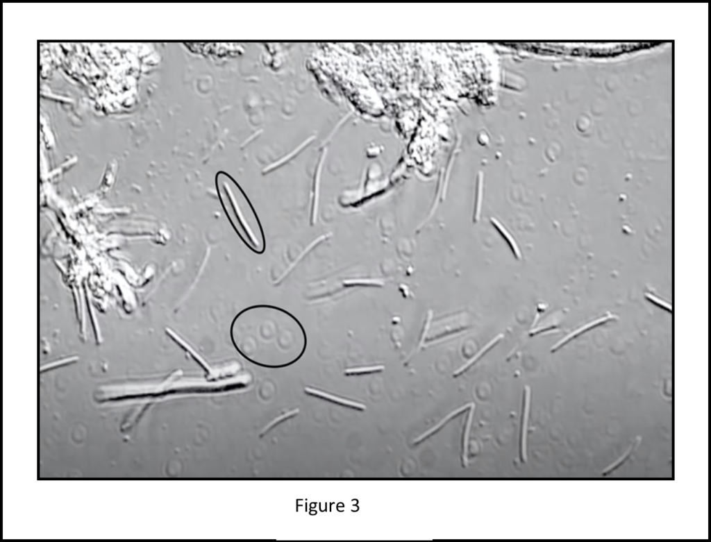 Plaque Analysis The Oral Health You Can See Oral Health Group