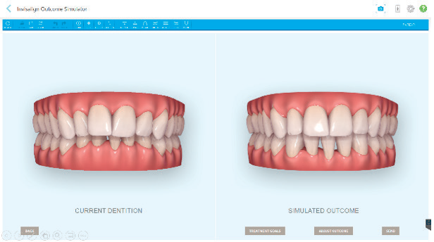 Clinical LATAM The science behind Invisalign & iTero - edição