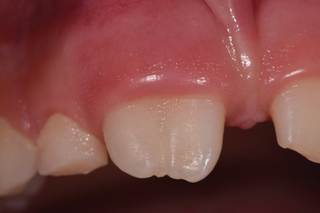 Preoperative Clinical Aspect