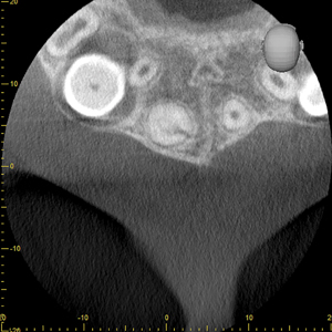 Axial view and
