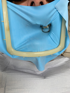 Rubber dam isolation eliminates contact with saliva and blood during endodontic treatment.