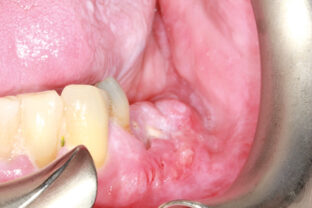 Robertson fig 6A - Oral Health Group