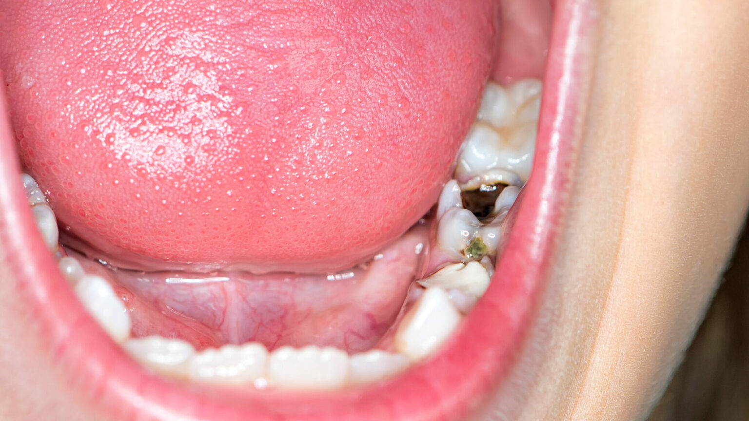 oraltissuesohy Oral Health Group