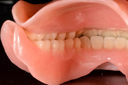 Spacing of custom trays for complete dentures