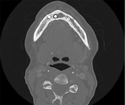 Altered Facial Sensation: Diagnostic Considerations - Oral Health Group