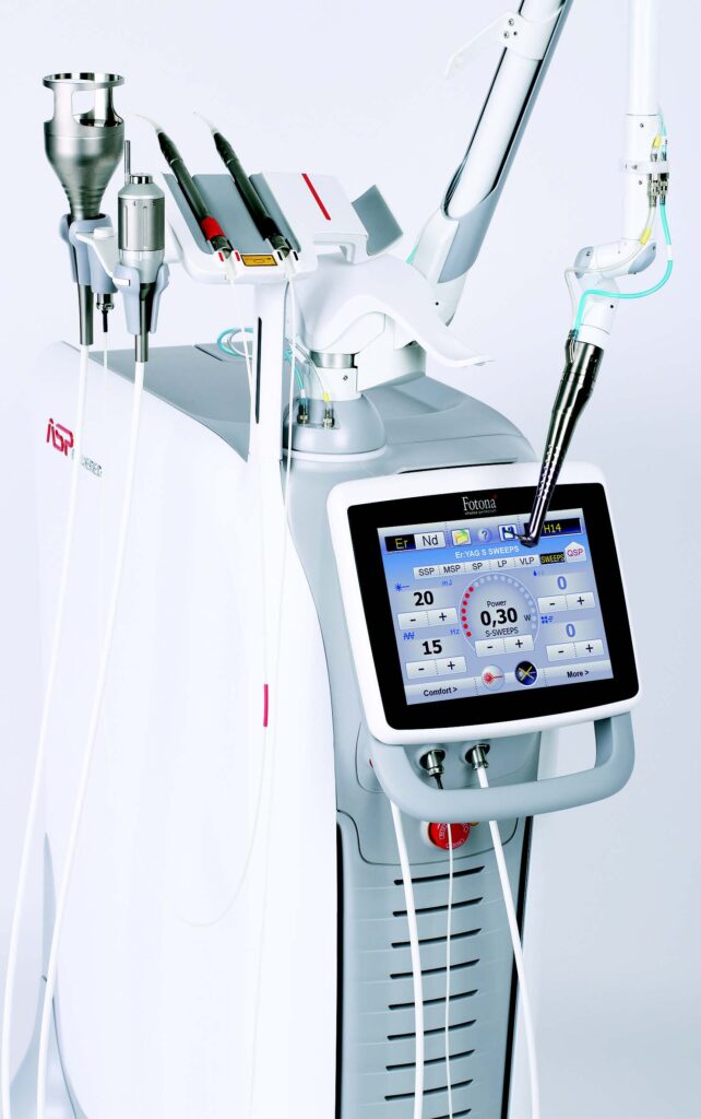 SWEEPS Modality Opens a New Era Digitally Pulsed Lasers, Endodontics