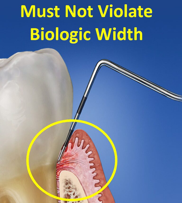 Managing and Maintaining the Periodontalrestorative Interface