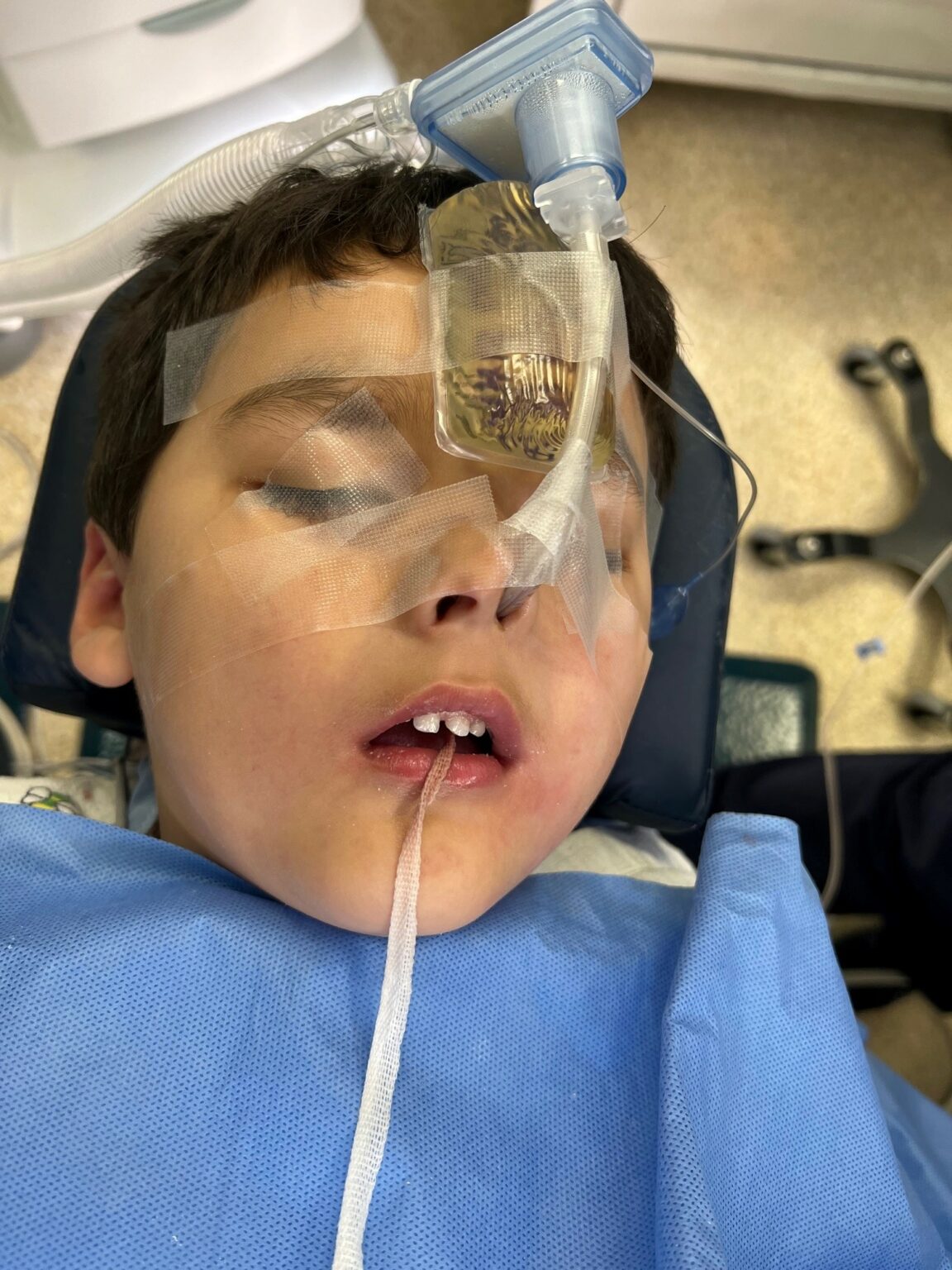 Anesthesiologist’s Role in the Perioperative Care for Pediatric Dental