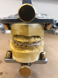  Traditional single jaw surgery involving mounted stone models on a Galetti articulator and fabrication of an acrylic splint.  
